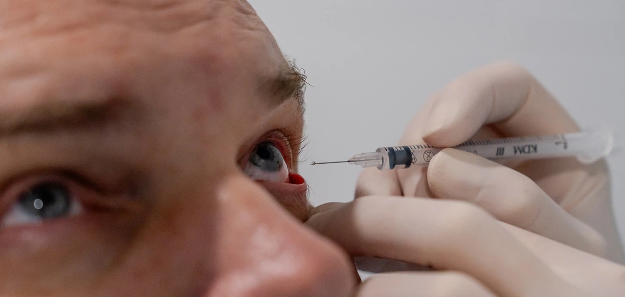 Инъекции в стекловидное тело