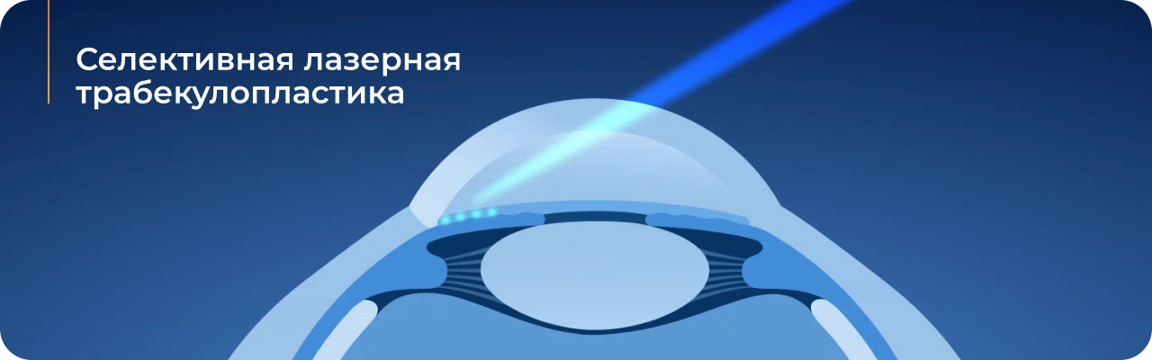 Лечение глаукомы