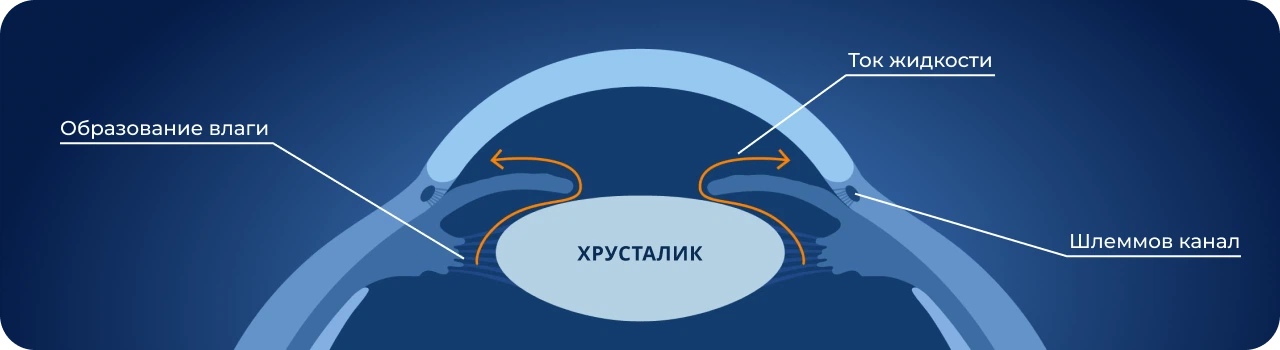 Осложнения афакии