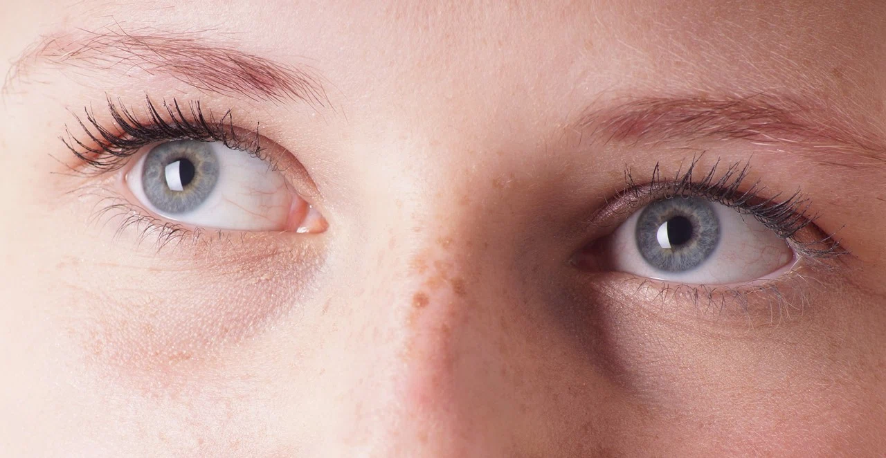 Черные точки в глазах