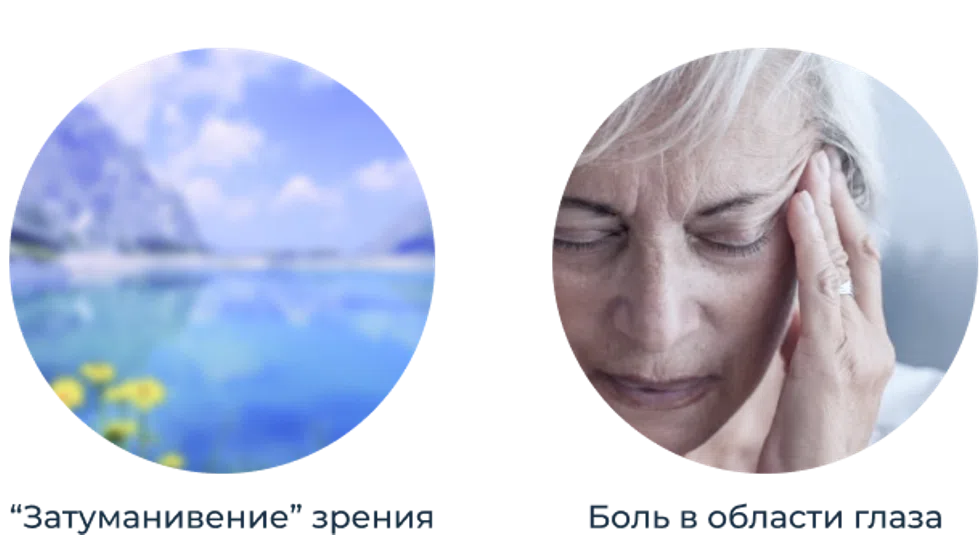 Симптомы симпатической офтальмии