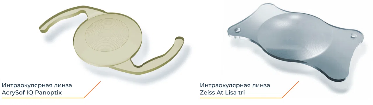 Производители искусственных хрусталиков