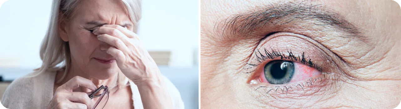 Механизм развития глаукомы