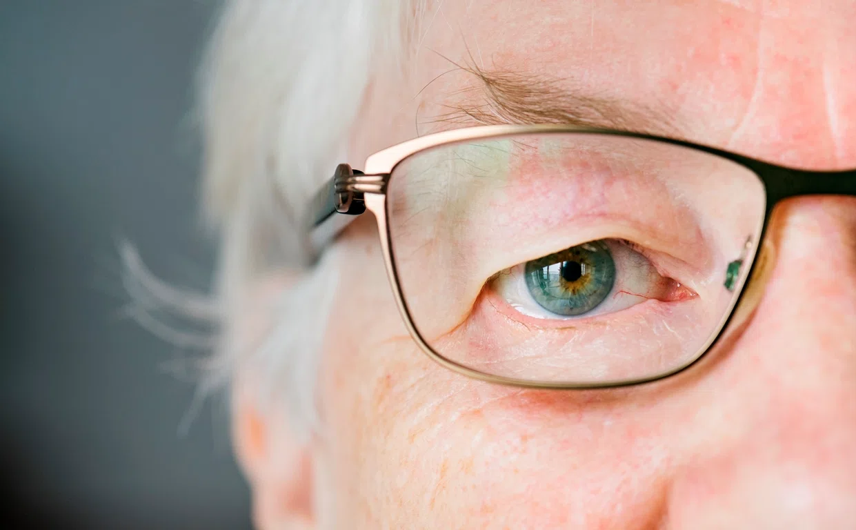 Глаукома нормального давления