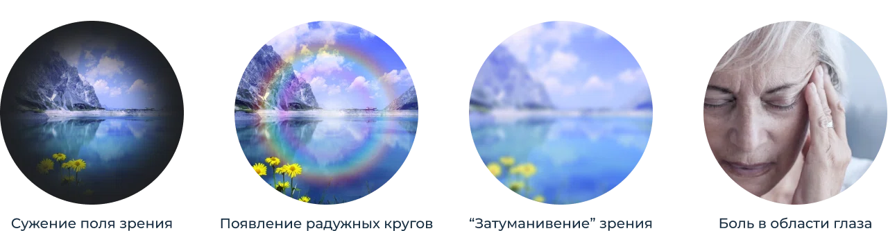 Симптомы глаукомы