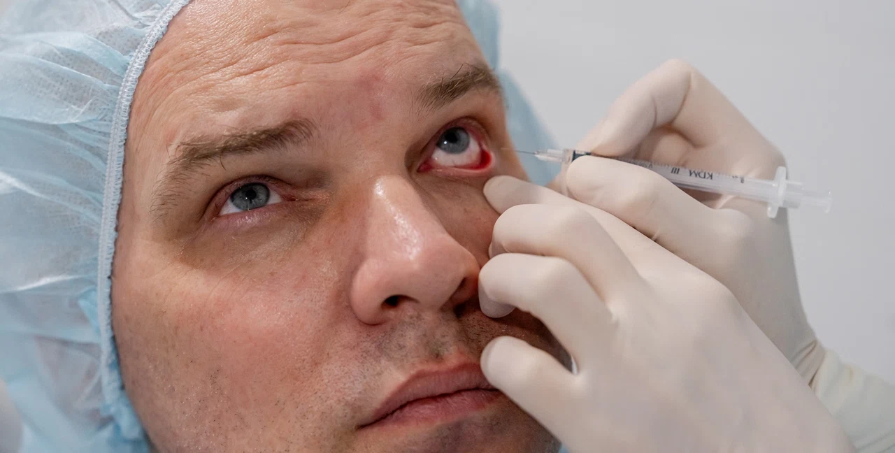 Введение интравитреальных инъекций