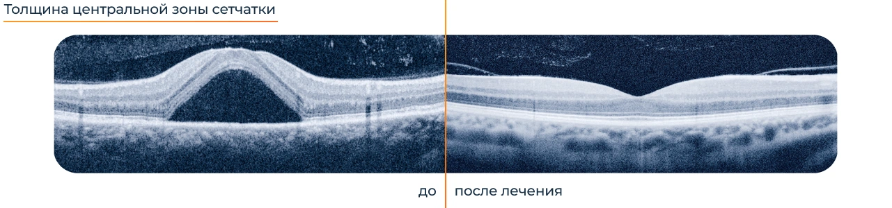 Прогноз лечения