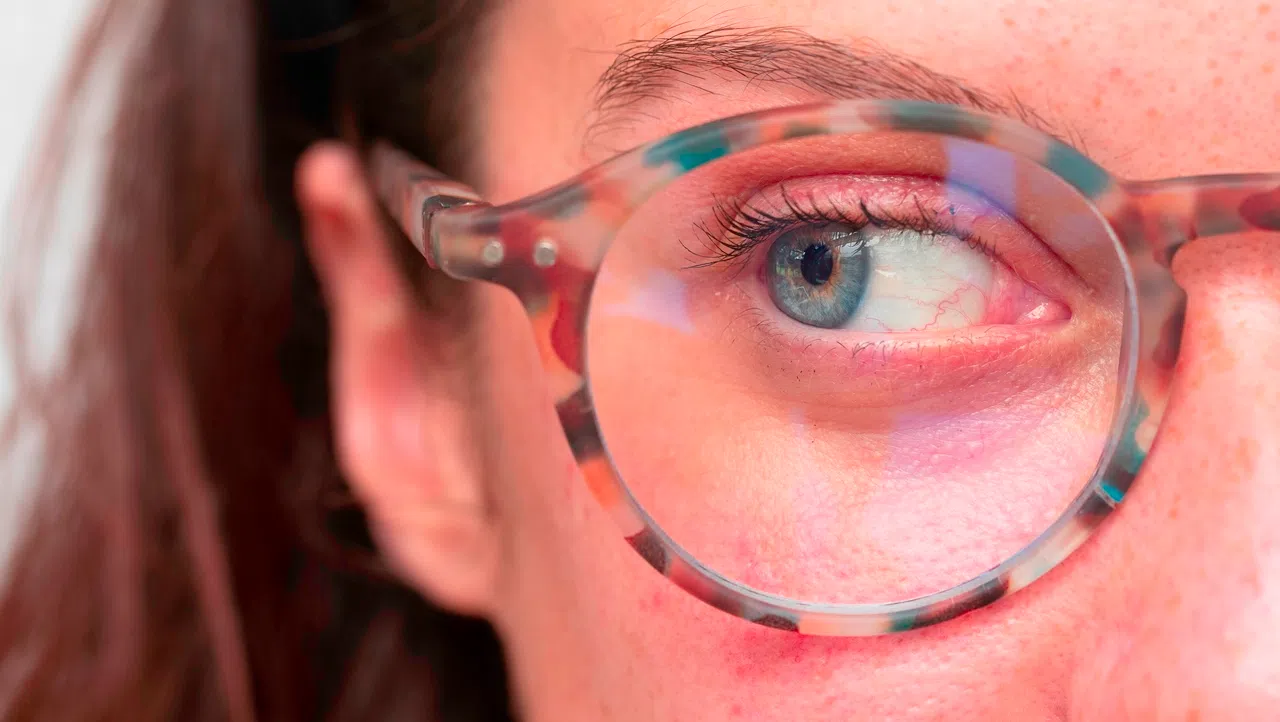 Причины развития ангиопатии сетчатки